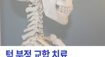 턱 부정 교합 치료 양악수술이 답인가요? ‘이것’ 부터 확인하세요.