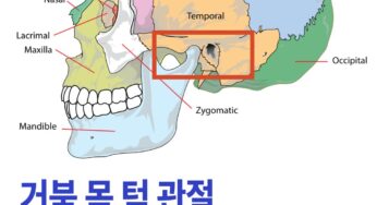 거북 목이 턱 관절 장애의 원인 ‘이것’ 고쳐야 둘 다 나을 수 있습니다.