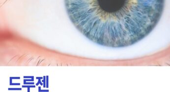 드루젠 황반변성 원인 제거 방법