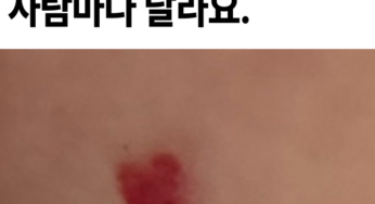 몸 에 붉은 점이 생기는 이유 ‘이 것’에 따라 치료방법이 달라집니다.